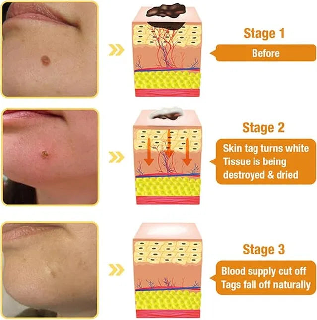 Meltdown Gel Cream for Acne-Prone Skin with 72 hour Hydration