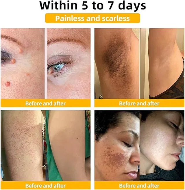 Meltdown Gel Cream for Acne-Prone Skin with 72 hour Hydration