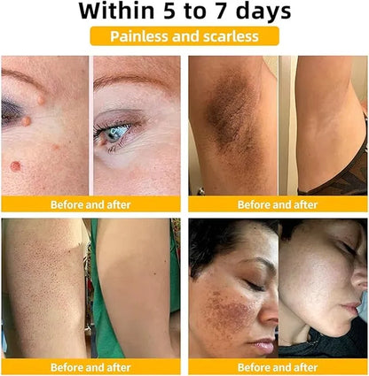 Meltdown Gel Cream for Acne-Prone Skin with 72 hour Hydration